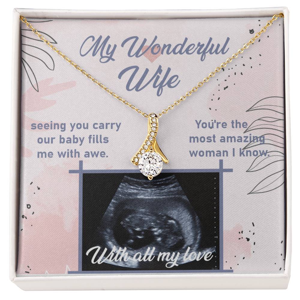 Ultrasound Image, Pregnancy Reveal, Baby Announcement, Pregnancy Announcement, Ultrasound Picture, Ultrasound Photo, Coming Soon