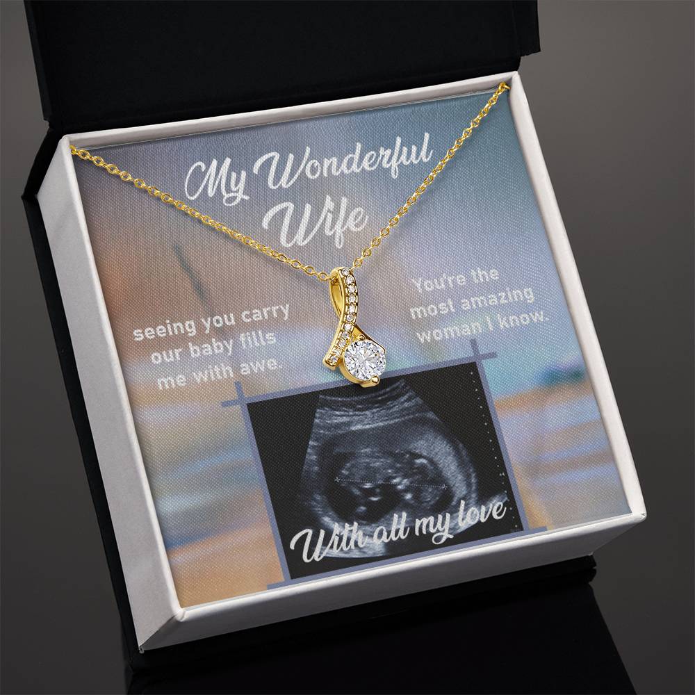 Ultrasound Image, Pregnancy Reveal, Baby Announcement, Pregnancy Announcement, Ultrasound Picture, Ultrasound Photo, Coming Soon