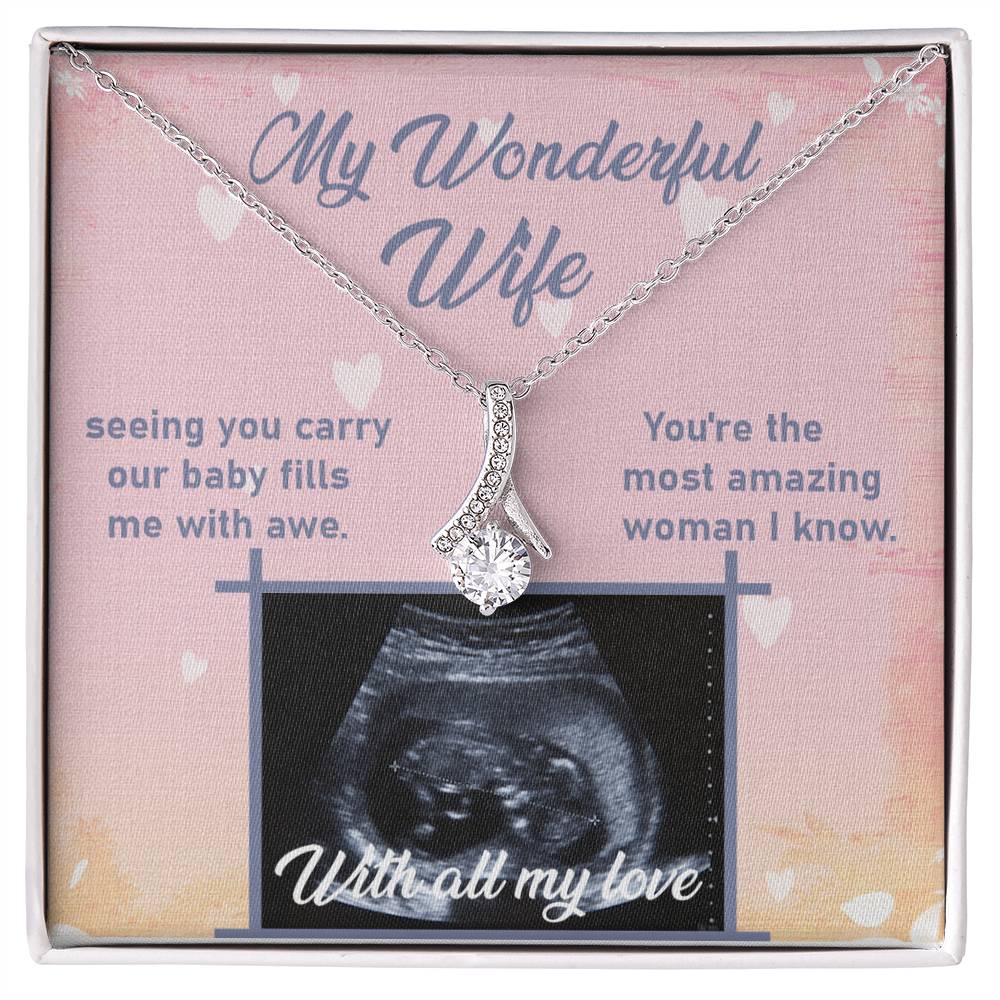 Ultrasound Image, Pregnancy Reveal, Baby Announcement, Pregnancy Announcement, Ultrasound Picture, Ultrasound Photo, Coming Soon